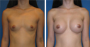 Before & After Photos